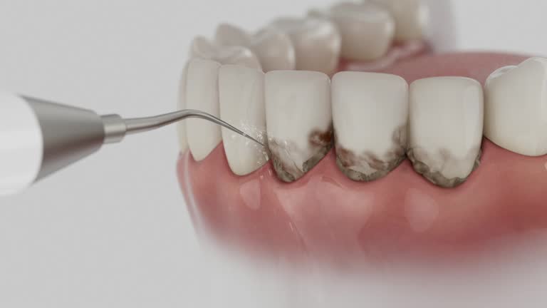 Reliable Emergency Dentist contractor in Norco, CA by Smile Center Dentistry
